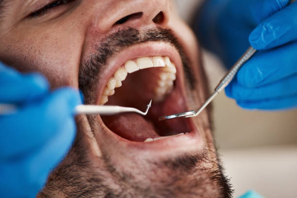 Best Wisdom Tooth Removal  in Moyie Springs, ID
